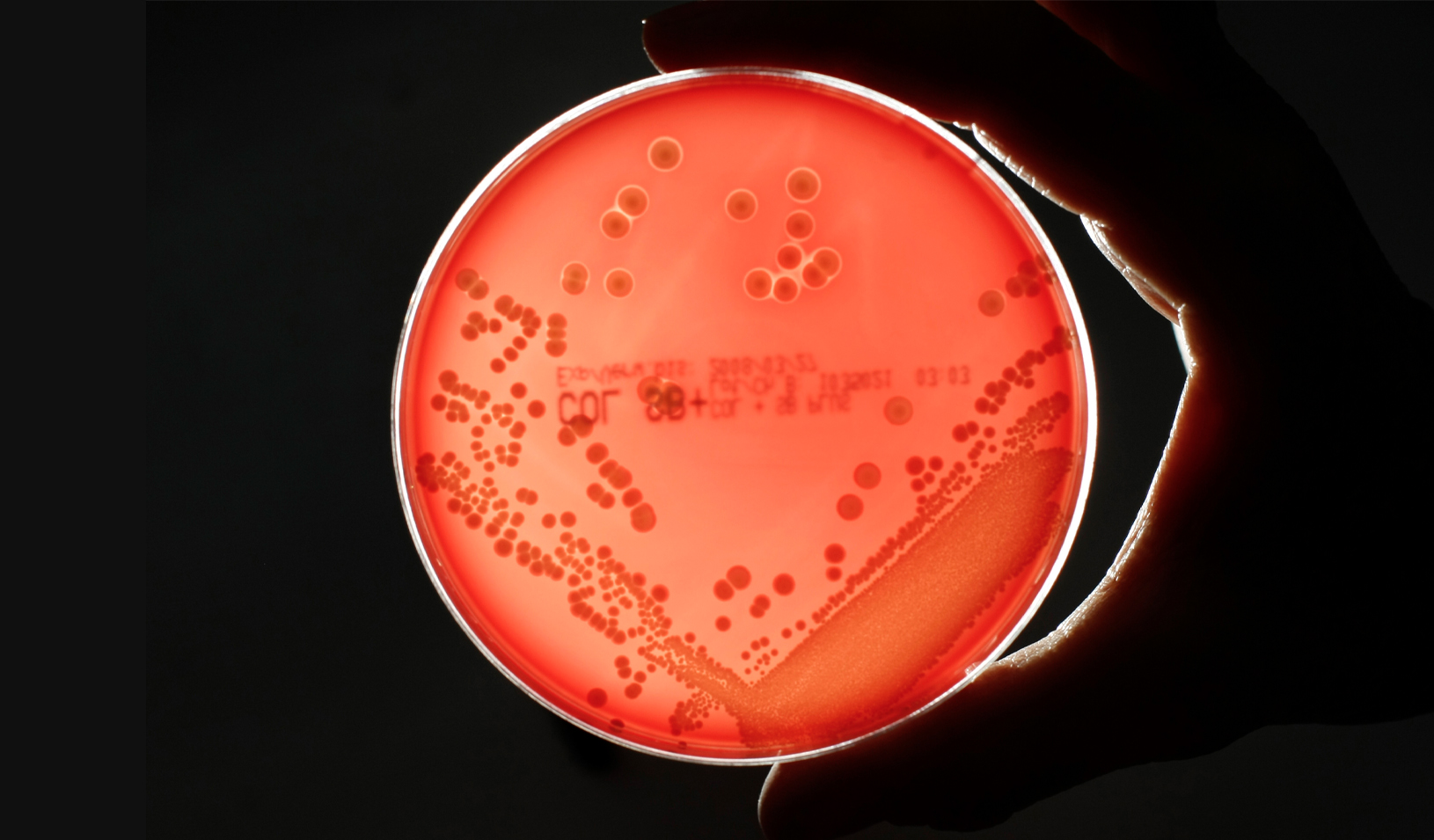 MRSA (Methicillin-resistant Staphylococcus aureus) bacteria strain is seen in a petri dish containing agar jelly for bacterial culture in a microbiological laboratory. MRSA is a drug-resistant "superbug", which can cause deadly infections. | Credit: REUTERS/Fabrizio Bensch.